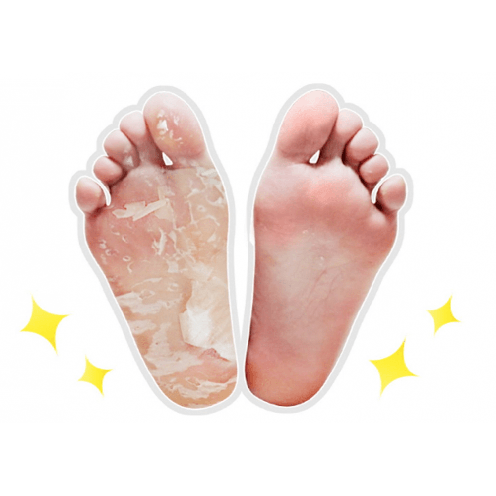 DEARDERM PYT Foot Peeling Essence Mask